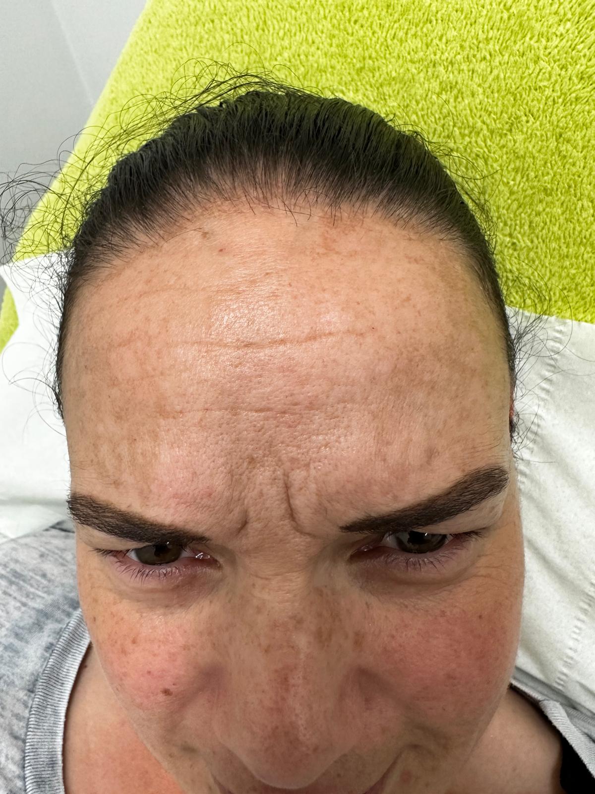 Anti-Wrinkle before