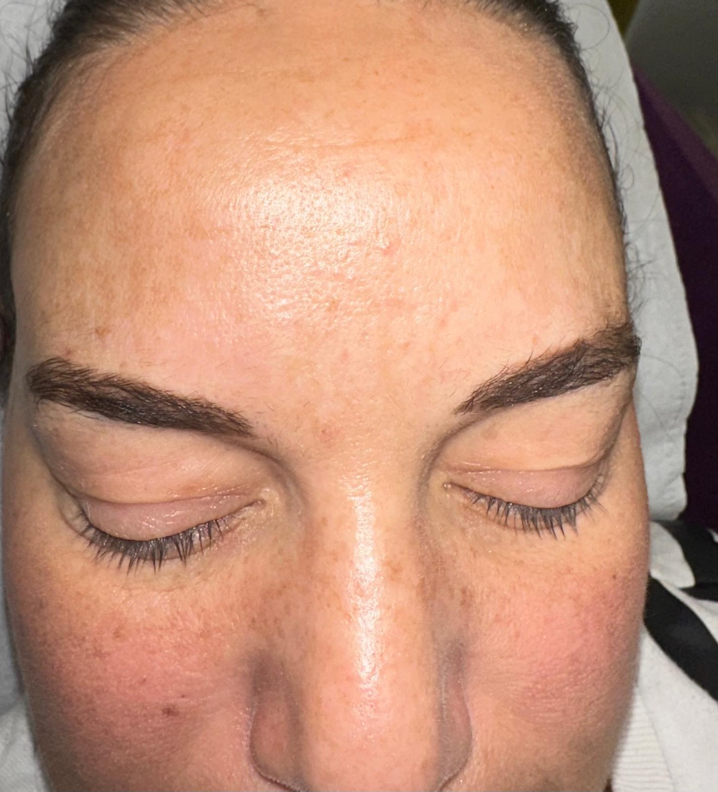 Anti-Wrinkle after