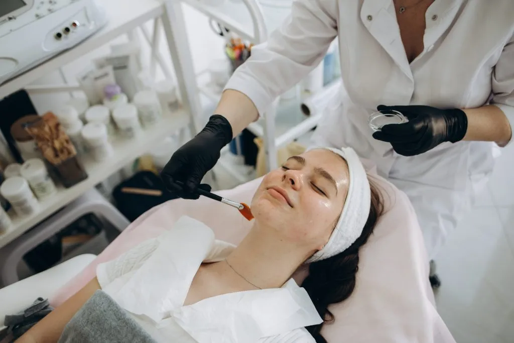 Chemical peel treatment