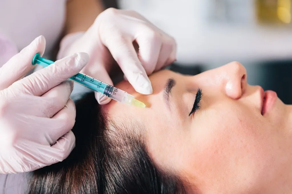 Dermal filler treatment