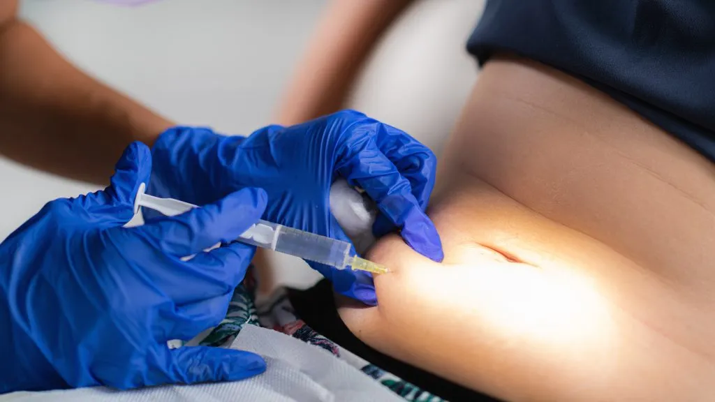 Fat dissolving treatment